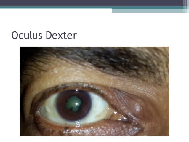 Get Dexter The Eye PNG